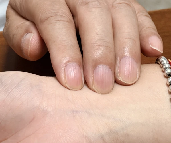 Fingertip pulse assessment / 指尖触脉辨证
